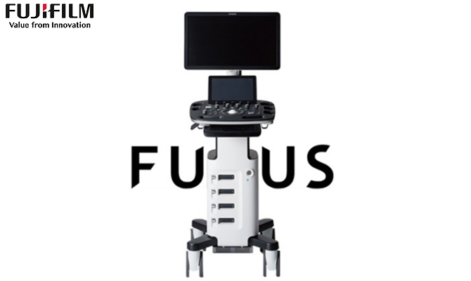 超音波システム(フルデジタル高精度機種)