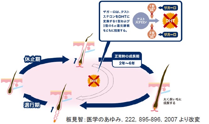 ザガーロのデュアル発毛効果