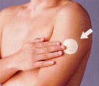 ニコチネルTTS貼付(ニコチン貼付剤)