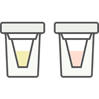 ウレアーゼ試験